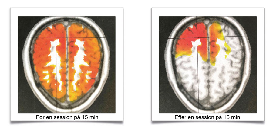 Draper Sensory Method før og efter EEG-måling